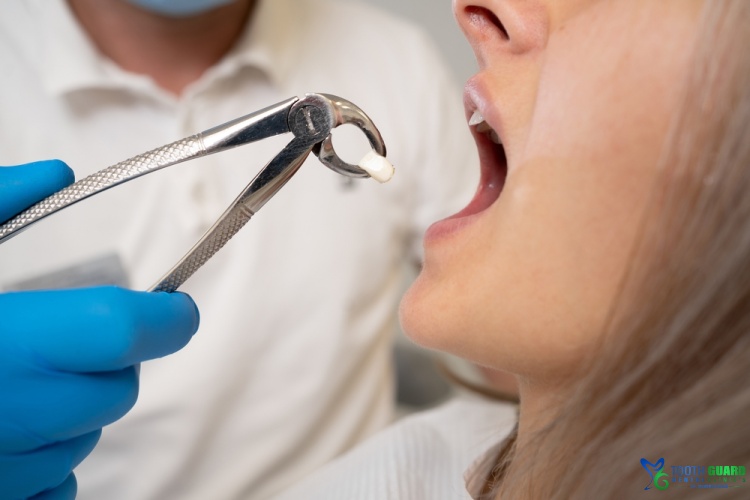متى تلتئم اللثة بعد خلع الضرس